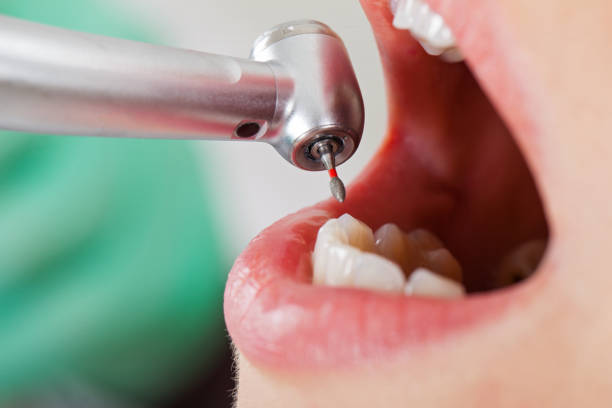 Best Emergency Care for Gum Disease in Salisbury, MO